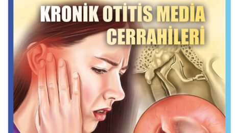 kronik otitis media cerrahileri kronik otitis media cerrahileri