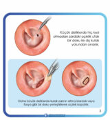 kronik otitis media cerrahileri kronik otitis media cerrahileri