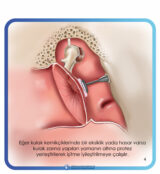 kronik otitis media cerrahileri kronik otitis media cerrahileri