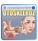Otoskleroz 2 Otoskleroz 2