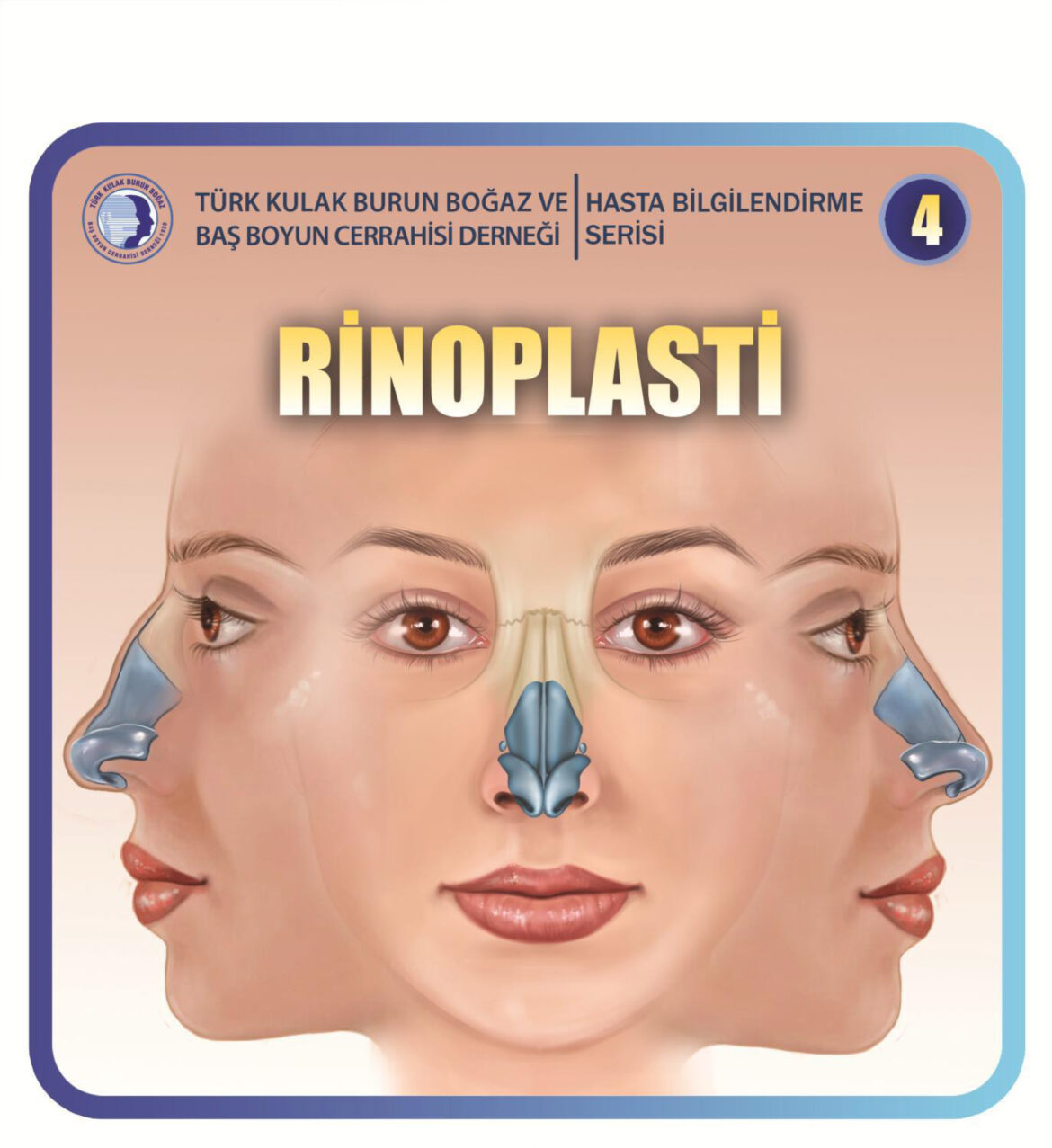 rinoplasti