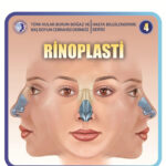 rinoplasti