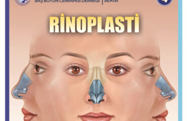 rinoplasti rinoplasti