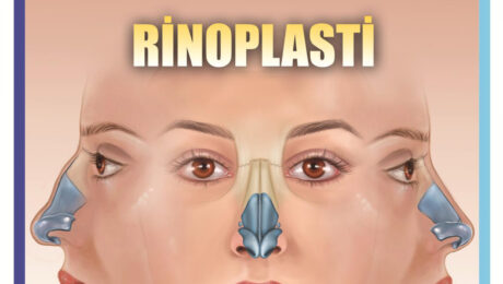 rinoplasti rinoplasti