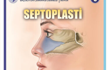 septoplasti septoplasti