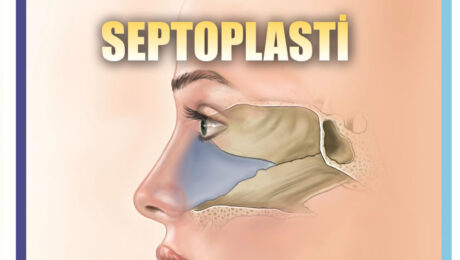 septoplasti septoplasti