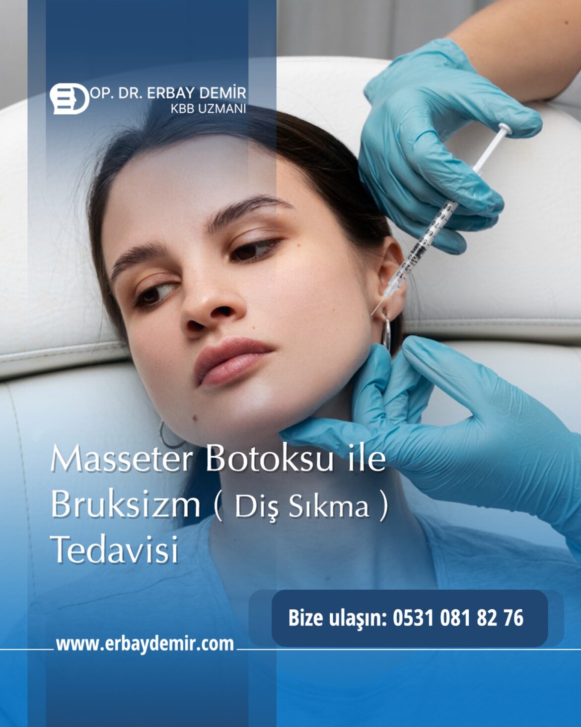 masseter botoksu