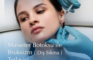 masseter botoksu